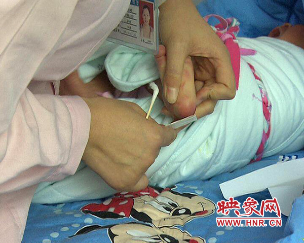 醫(yī)護(hù)人員在為一名新出生嬰兒采足跟血，做疾病篩查