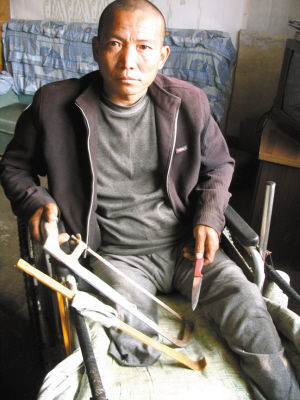 鄭艷良就是用這幾樣簡陋工具，給自己做了右腿截肢手術(shù)。