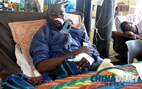 雖然已經(jīng)在醫(yī)院接受了近一個月的恢復(fù)治療，卡托卡的身體仍然非常虛弱。