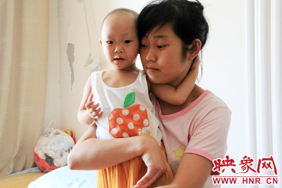 孩子和媽媽在一起，她的右眼已經(jīng)失明。