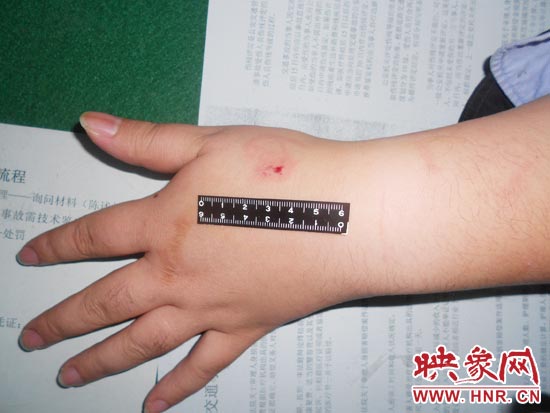 為幫助無證駕駛的朋友逃避處罰，新鄉(xiāng)的王某竟對執(zhí)勤民警大打出手，還將一名民警的手臂咬傷