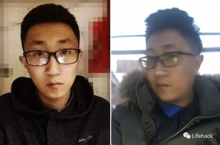 長胖20斤，臉型怎么變？這些例子看完扎心了！