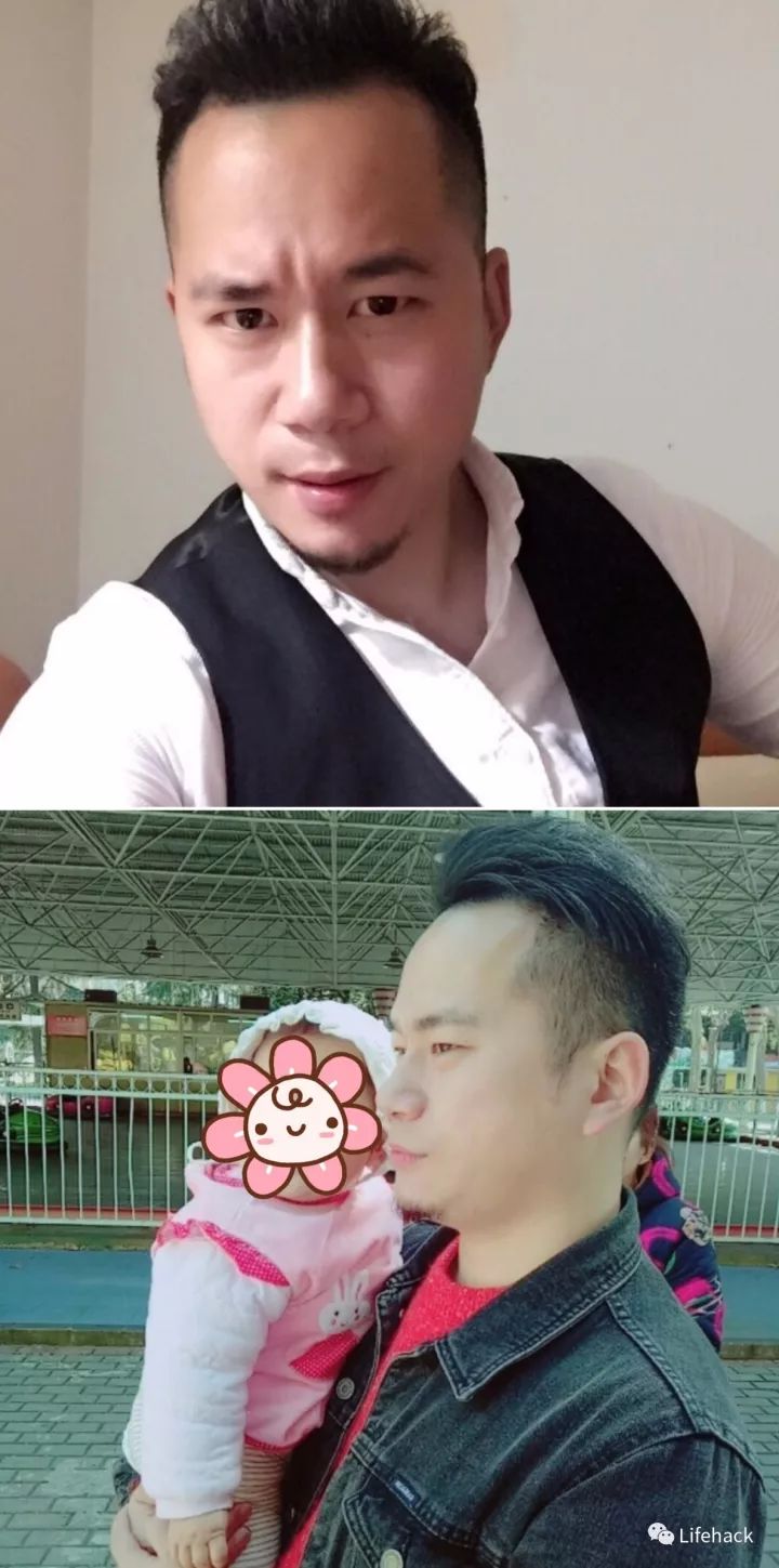 長胖20斤，臉型怎么變？這些例子看完扎心了！