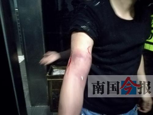 覃先生手臂被卡的部位受傷流血，所幸傷勢(shì)無大礙。 通訊員 王建民 攝