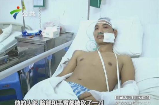 另一名傷者頭部、臉部和手臂都被砍了一刀。(視頻截圖)