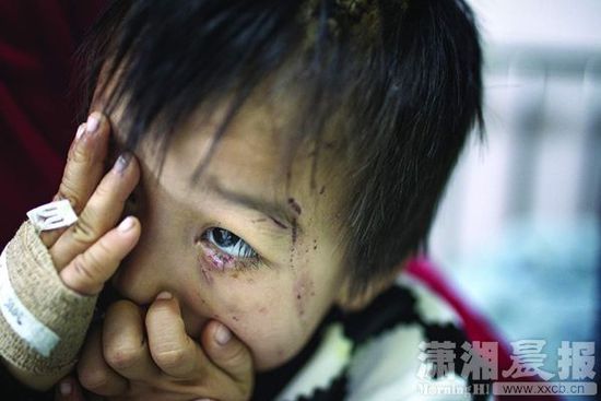 1月13日，湖南省兒童醫(yī)院，4歲的源源用手蒙住了眼睛。