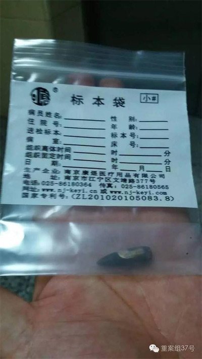 經(jīng)警方鑒定，秦女士體內(nèi)取出的子彈系56式步槍射出 。 受訪者供圖